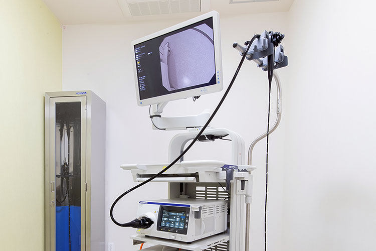 胃カメラ（経鼻内視鏡）検査のイメージ